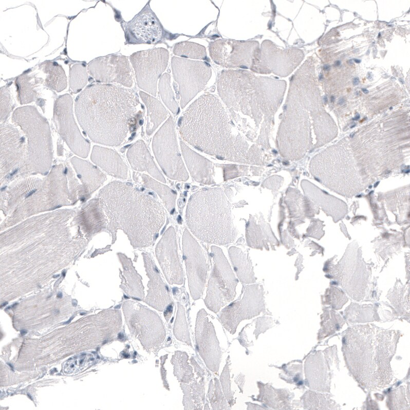 HO-1/HMOX1/HSP32 Antibody (CL11669) - Azide and BSA Free Immunohistochemistry-Paraffin: HO-1/HMOX1/HSP32 Antibody [NBP3-44184]