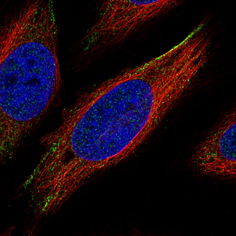 ROR2 Antibody (CL5950) - Azide and BSA Free Immunocytochemistry/ Immunofluorescence: ROR2 Antibody [NBP3-44186]