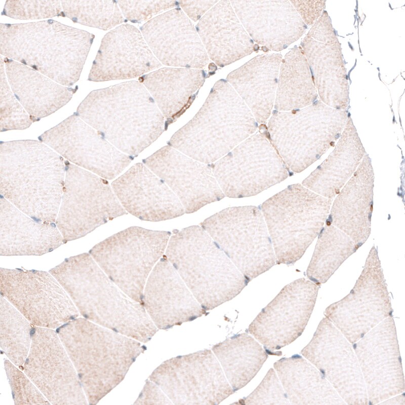 ROR2 Antibody (CL5950) - Azide and BSA Free Immunohistochemistry-Paraffin: ROR2 Antibody [NBP3-44186]
