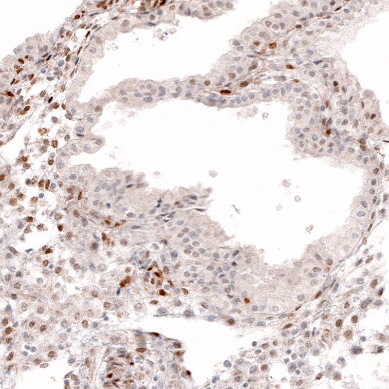 SOX4 Antibody (CL5634) - Azide and BSA Free Immunohistochemistry-Paraffin: SOX4 Antibody [NBP3-44187]