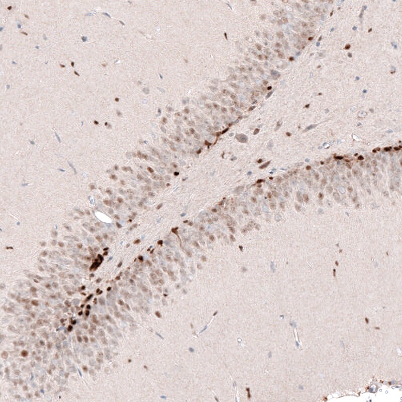 SOX4 Antibody (CL5634) - Azide and BSA Free Immunohistochemistry-Paraffin: SOX4 Antibody [NBP3-44187]
