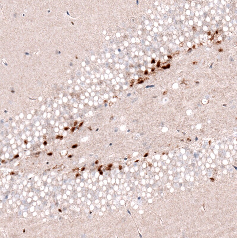 SOX4 Antibody (CL5634) - Azide and BSA Free Immunohistochemistry-Paraffin: SOX4 Antibody [NBP3-44187]