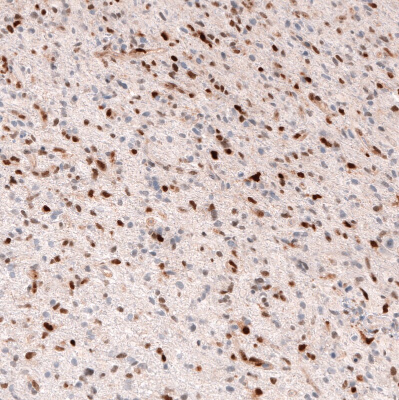 SOX4 Antibody (CL5665) - Azide and BSA Free Immunohistochemistry-Paraffin: SOX4 Antibody [NBP3-44188]