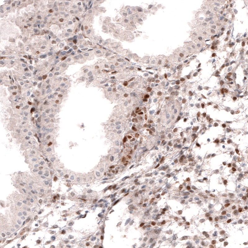 SOX4 Antibody (CL5665) - Azide and BSA Free Immunohistochemistry-Paraffin: SOX4 Antibody [NBP3-44188]
