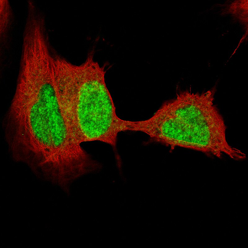 SOX4 Antibody (CL5665) - Azide and BSA Free Immunocytochemistry/ Immunofluorescence: SOX4 Antibody [NBP3-44188]