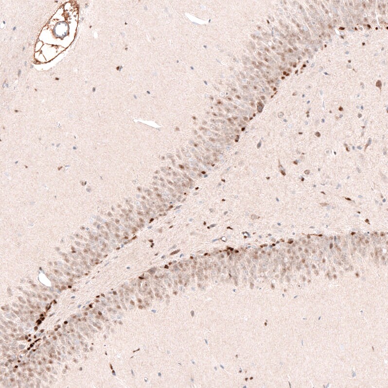 SOX4 Antibody (CL5665) - Azide and BSA Free Immunohistochemistry-Paraffin: SOX4 Antibody [NBP3-44188]