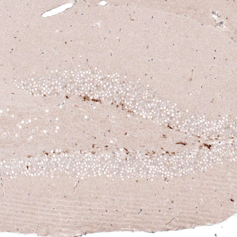 SOX4 Antibody (CL5665) - Azide and BSA Free Immunohistochemistry-Paraffin: SOX4 Antibody [NBP3-44188]
