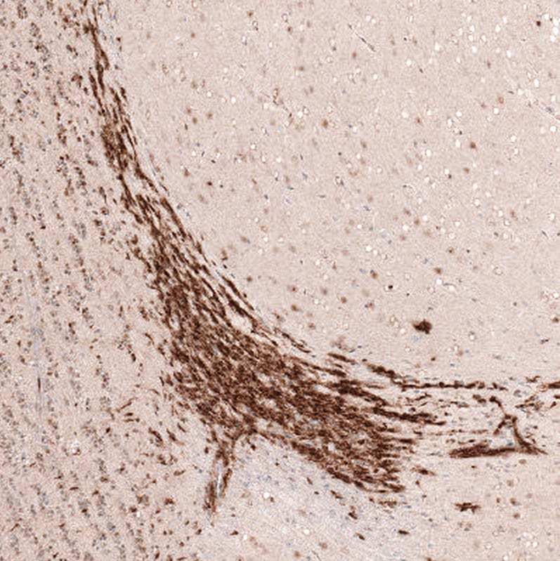 SOX4 Antibody (CL5665) - Azide and BSA Free Immunohistochemistry-Paraffin: SOX4 Antibody [NBP3-44188]