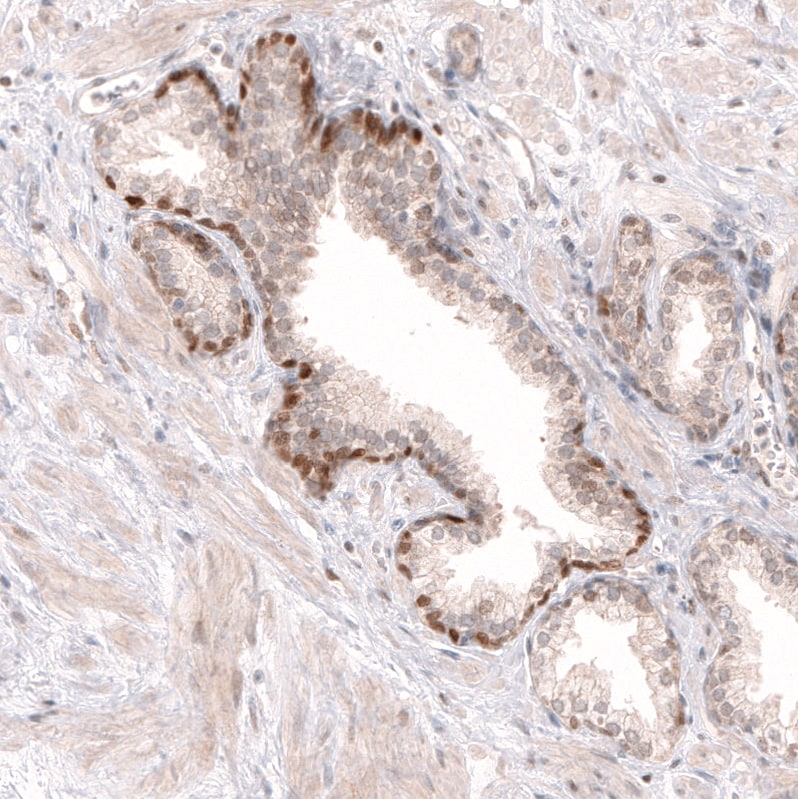 SOX4 Antibody (CL5665) - Azide and BSA Free Immunohistochemistry-Paraffin: SOX4 Antibody [NBP3-44188]