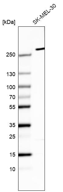myosin X Antibody (CL9025) - Azide and BSA Free Western Blot: myosin X Antibody [NBP3-44190]