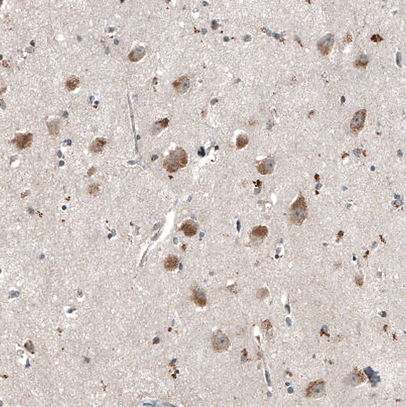 myosin X Antibody (CL9032) - Azide and BSA Free Immunohistochemistry-Paraffin: myosin X Antibody [NBP3-44191]