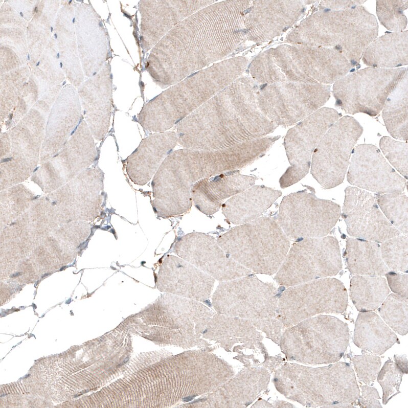 myosin X Antibody (CL9032) - Azide and BSA Free Immunohistochemistry-Paraffin: myosin X Antibody [NBP3-44191]