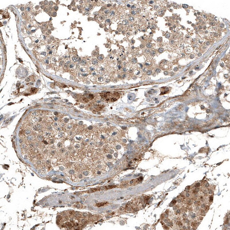 myosin X Antibody (CL9032) - Azide and BSA Free Immunohistochemistry-Paraffin: myosin X Antibody [NBP3-44191]