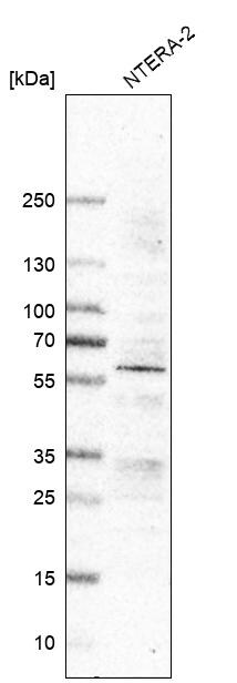 RGM-A Antibody (CL11342) - Azide and BSA Free Western Blot: RGM-A Antibody [NBP3-44194]