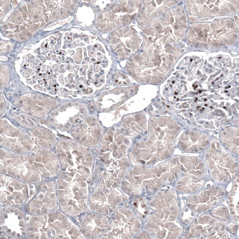 GATA-3 Antibody (CL8660) - Azide and BSA Free Immunohistochemistry-Paraffin: GATA-3 Antibody [NBP3-44195]