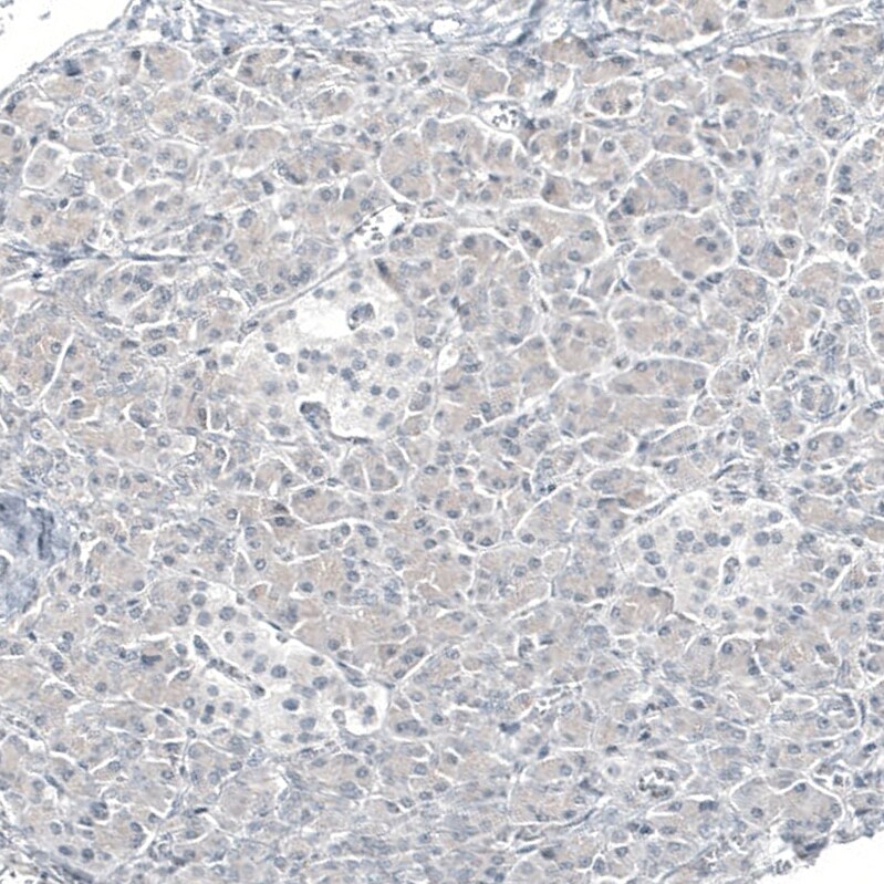 GATA-3 Antibody (CL8660) - Azide and BSA Free Immunohistochemistry-Paraffin: GATA-3 Antibody [NBP3-44195]