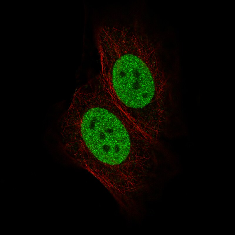 GATA-3 Antibody (CL8660) - Azide and BSA Free Immunocytochemistry/ Immunofluorescence: GATA-3 Antibody [NBP3-44195]