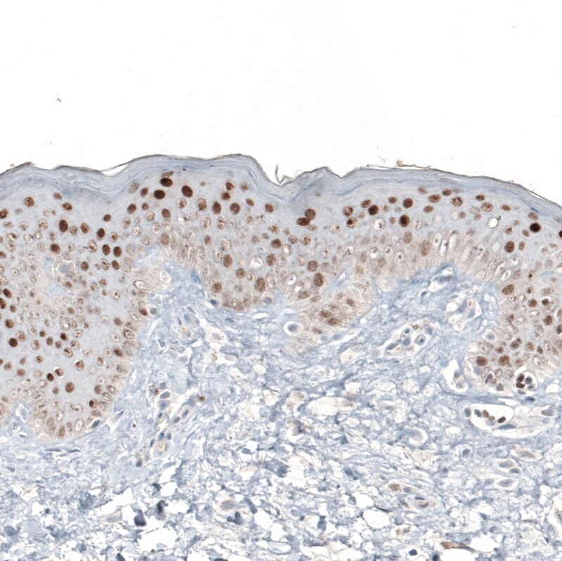 GATA-3 Antibody (CL8660) - Azide and BSA Free Immunohistochemistry-Paraffin: GATA-3 Antibody [NBP3-44195]