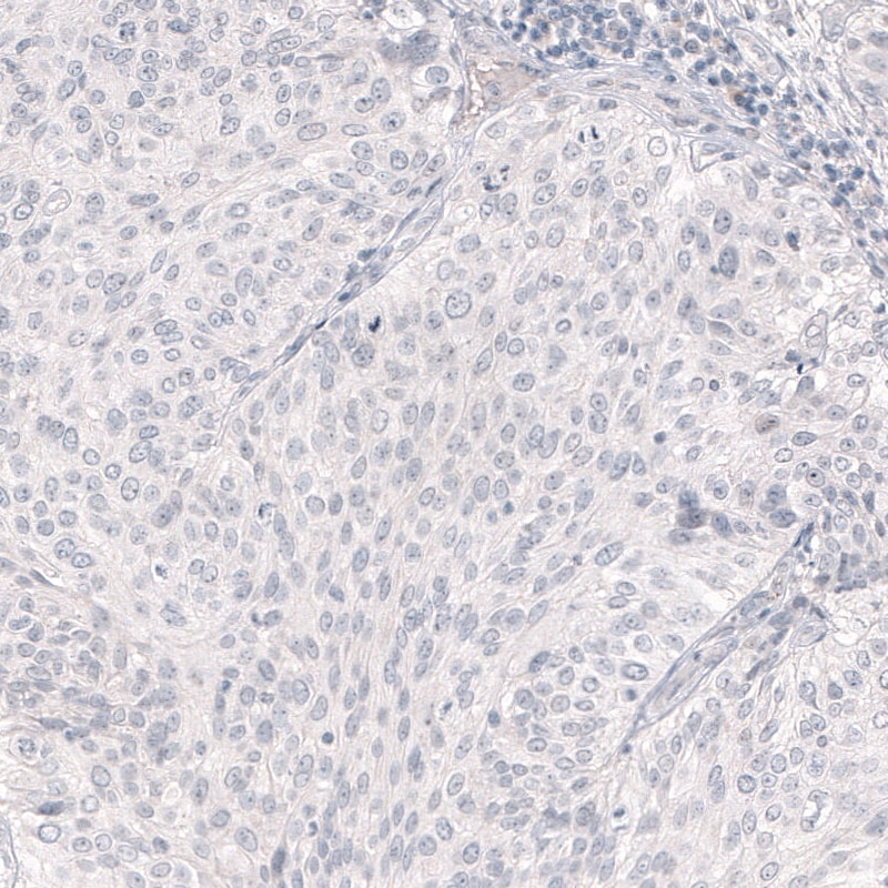 Nanog Antibody (CL5803) - Azide and BSA Free Immunohistochemistry-Paraffin: Nanog Antibody [NBP3-44196]