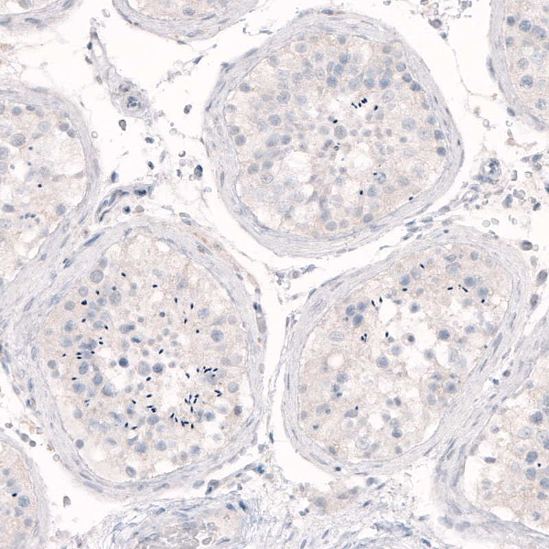 Nanog Antibody (CL5803) - Azide and BSA Free Immunohistochemistry-Paraffin: Nanog Antibody [NBP3-44196]