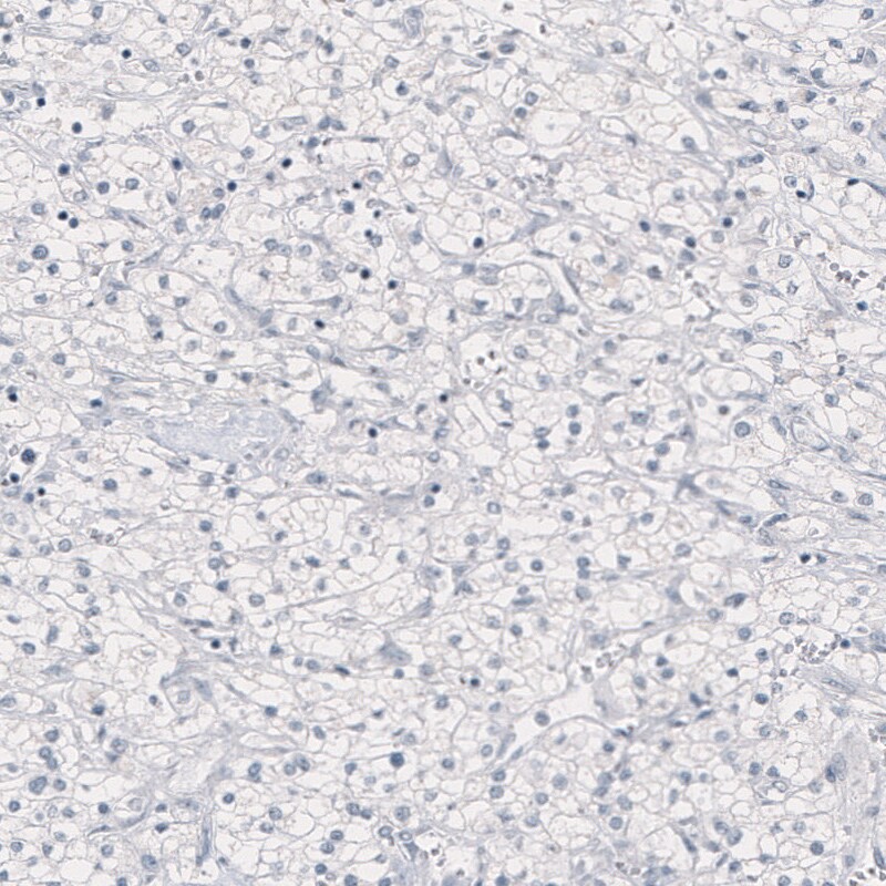 Nanog Antibody (CL5810) - Azide and BSA Free Immunohistochemistry-Paraffin: Nanog Antibody [NBP3-44197]
