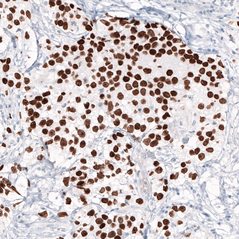 Nanog Antibody (CL5810) - Azide and BSA Free Immunohistochemistry-Paraffin: Nanog Antibody [NBP3-44197]