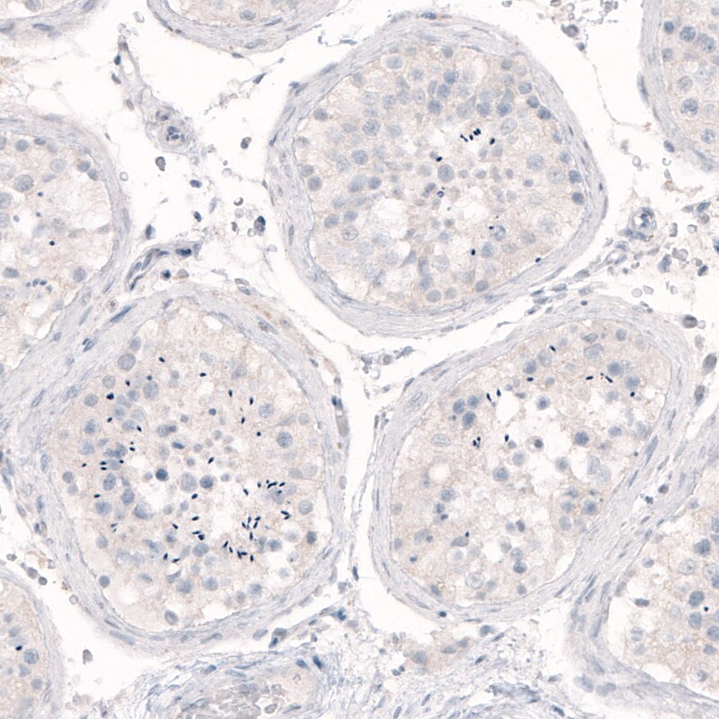 Nanog Antibody (CL5810) - Azide and BSA Free Immunohistochemistry-Paraffin: Nanog Antibody [NBP3-44197]