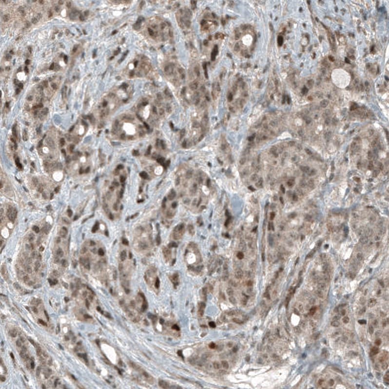 CDK2 Antibody (CL7990) - Azide and BSA Free Immunohistochemistry-Paraffin: CDK2 Antibody [NBP3-44198]