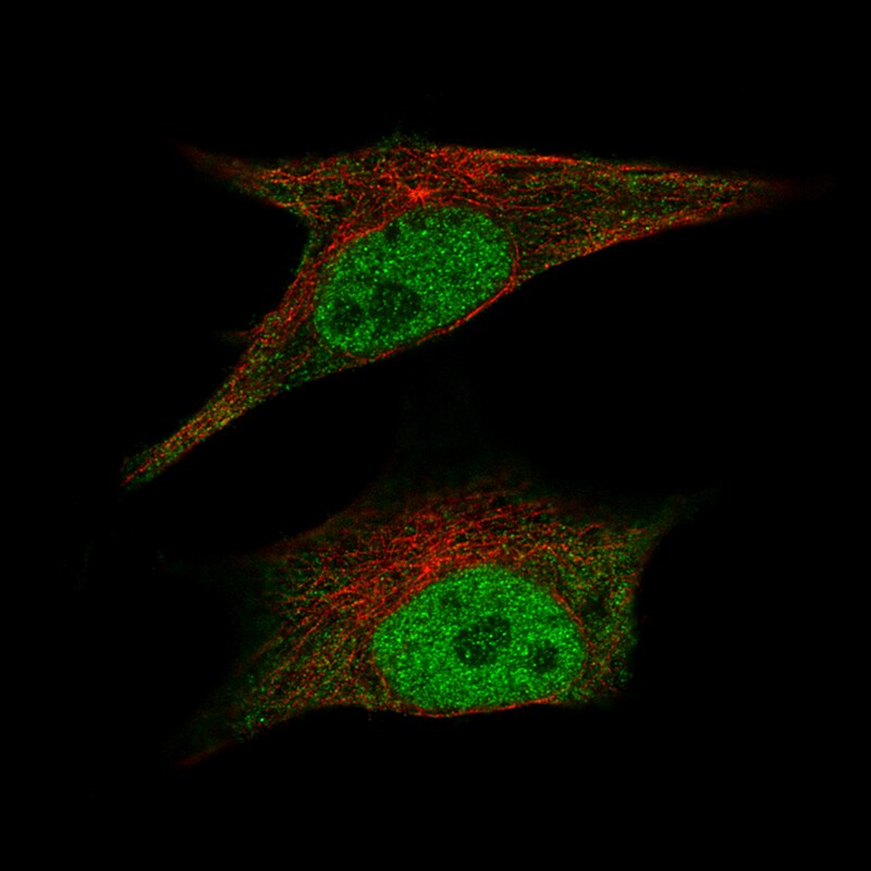 CDK2 Antibody (CL7990) - Azide and BSA Free Immunocytochemistry/ Immunofluorescence: CDK2 Antibody [NBP3-44198]