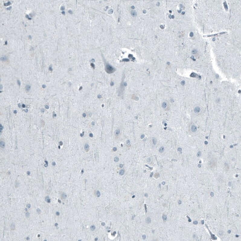 Androgen R/NR3C4 Antibody (CL9255) - Azide and BSA Free Immunohistochemistry-Paraffin: Androgen R/NR3C4 Antibody [NBP3-44204]