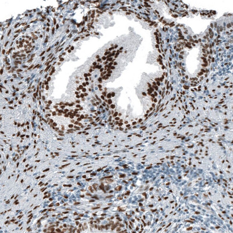 Androgen R/NR3C4 Antibody (CL9255) - Azide and BSA Free Immunohistochemistry-Paraffin: Androgen R/NR3C4 Antibody [NBP3-44204]