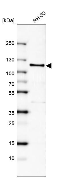 Androgen R/NR3C4 Antibody (CL9255) - Azide and BSA Free Western Blot: Androgen R/NR3C4 Antibody [NBP3-44204]