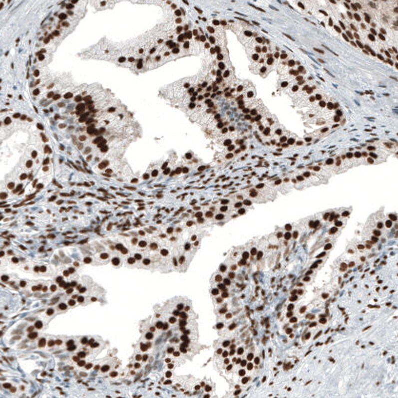 Androgen R/NR3C4 Antibody (CL9255) - Azide and BSA Free Immunohistochemistry-Paraffin: Androgen R/NR3C4 Antibody [NBP3-44204]