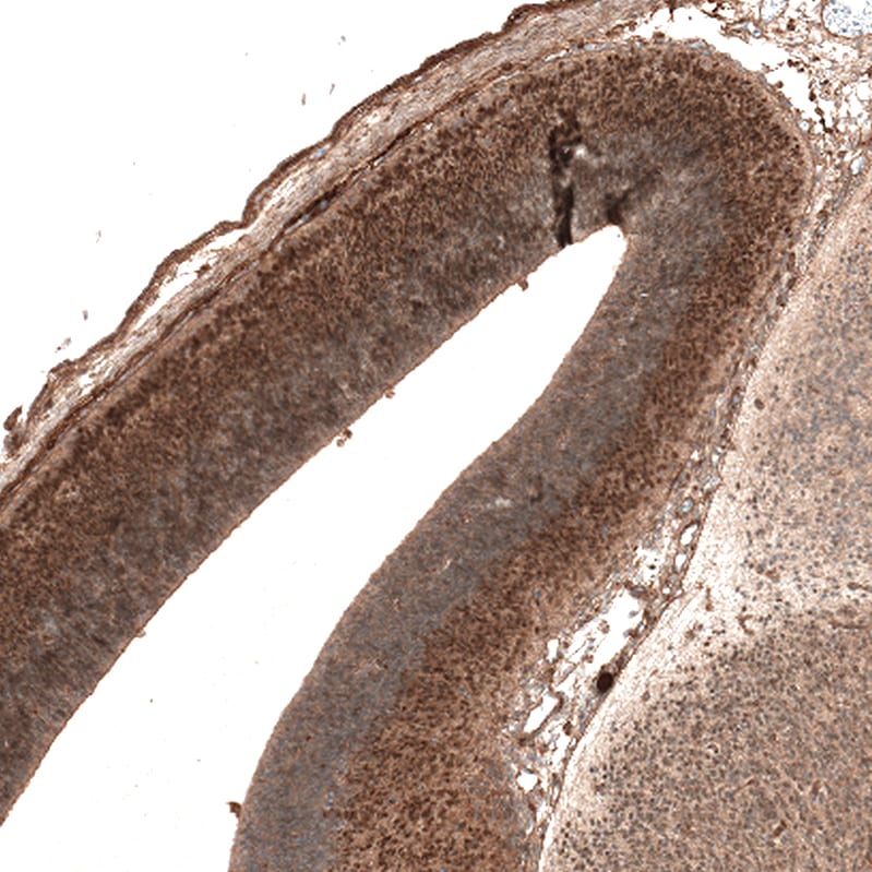 AUTS2 Antibody (CL7067) - Azide and BSA Free Immunohistochemistry-Paraffin: AUTS2 Antibody [NBP3-44205]