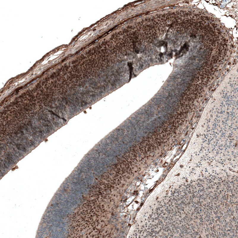 AUTS2 Antibody (CL7084) - Azide and BSA Free Immunohistochemistry-Paraffin: AUTS2 Antibody [NBP3-44206]