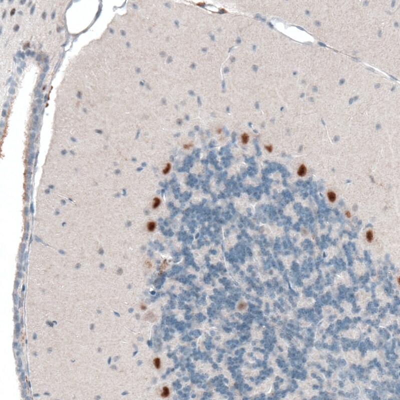 AUTS2 Antibody (CL7084) - Azide and BSA Free Immunohistochemistry-Paraffin: AUTS2 Antibody [NBP3-44206]