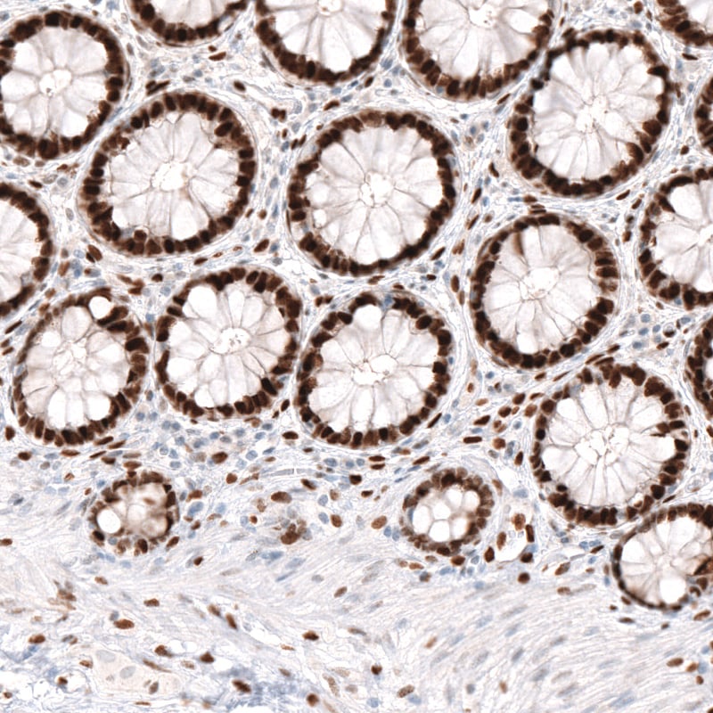 KLF4 Antibody (CL5782) - Azide and BSA Free Immunohistochemistry-Paraffin: KLF4 Antibody [NBP3-44207]