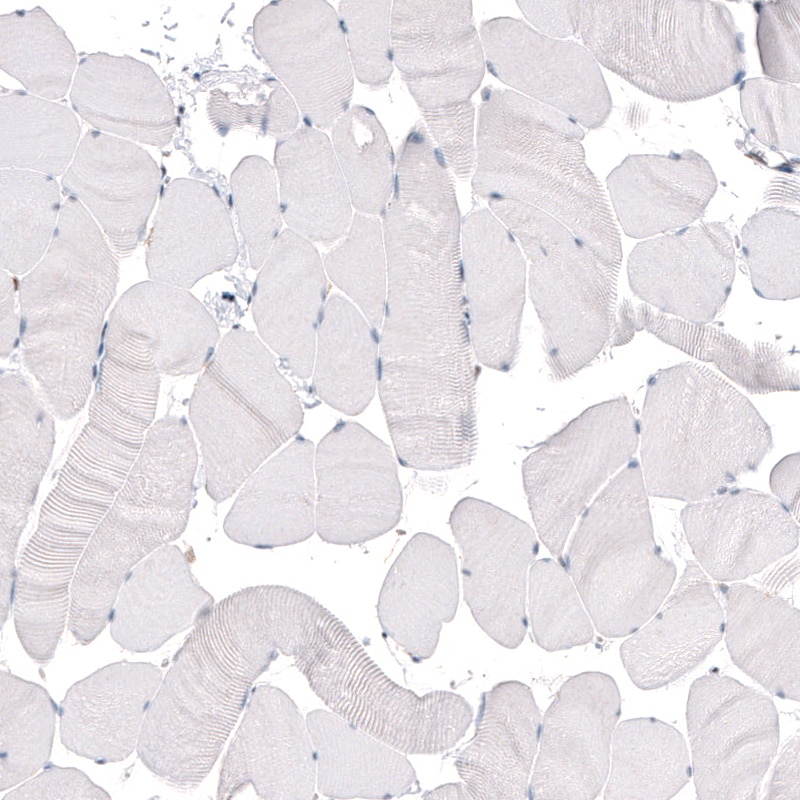 KLF4 Antibody (CL5785) - Azide and BSA Free Immunohistochemistry-Paraffin: KLF4 Antibody [NBP3-44208]