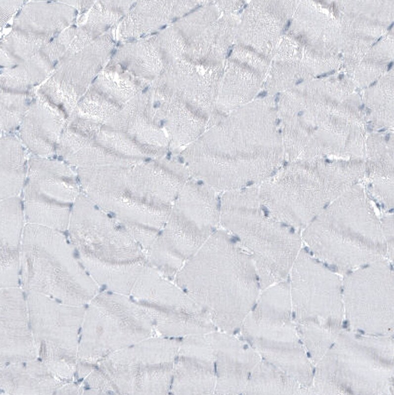 GLS2 Antibody (CL7716) - Azide and BSA Free Immunohistochemistry-Paraffin: GLS2 Antibody [NBP3-44209]