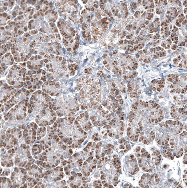 GLS2 Antibody (CL7721) - Azide and BSA Free Immunohistochemistry-Paraffin: GLS2 Antibody [NBP3-44210]