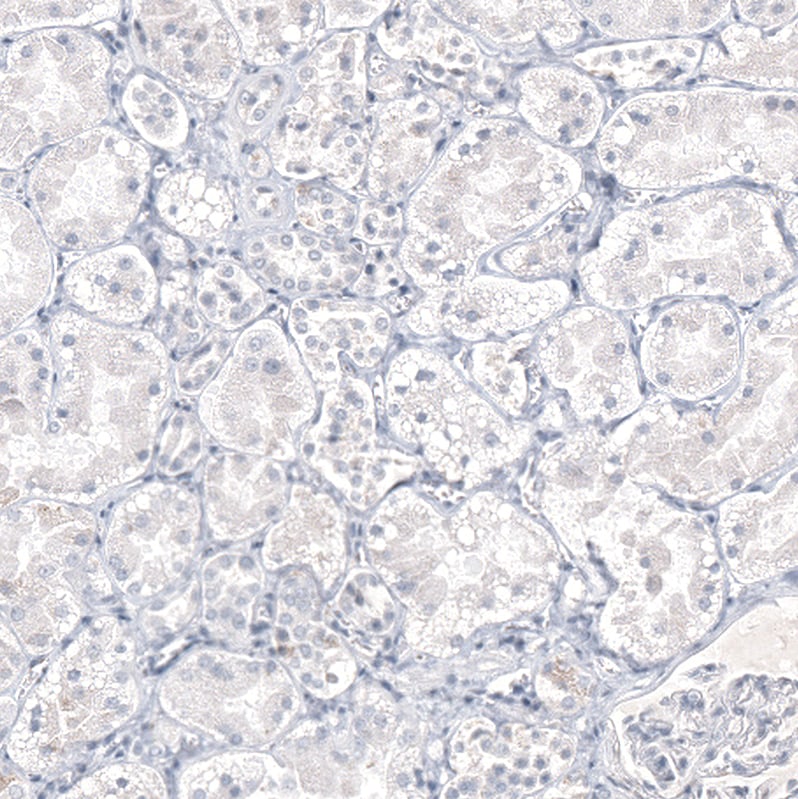 IL-17/IL-17A Antibody (CL10252) - Azide and BSA Free Immunohistochemistry-Paraffin: IL-17/IL-17A Antibody [NBP3-44212]