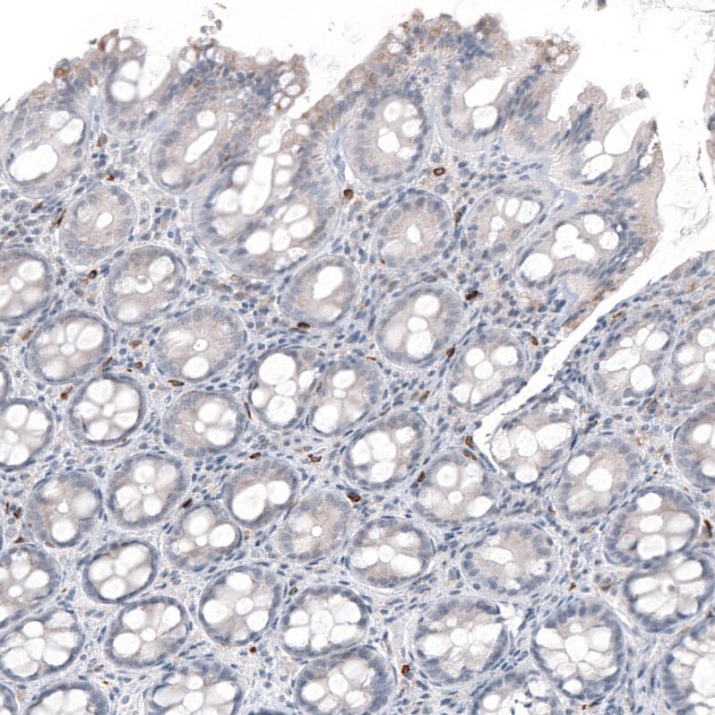 IL-17/IL-17A Antibody (CL10252) - Azide and BSA Free Immunohistochemistry-Paraffin: IL-17/IL-17A Antibody [NBP3-44212]