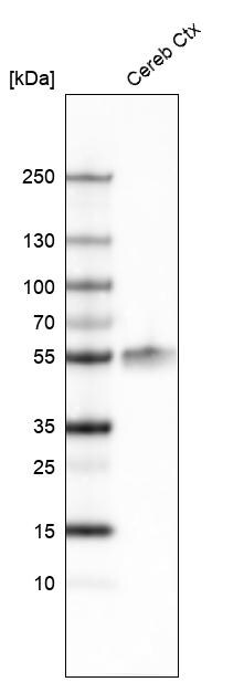 LHX2 Antibody (CL6137) - Azide and BSA Free Western Blot: LHX2 Antibody [NBP3-44215]