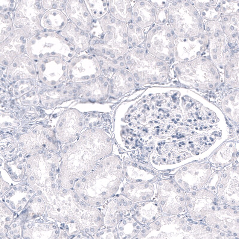 GPR17 Antibody (CL10474) - Azide and BSA Free Immunohistochemistry-Paraffin: GPR17 Antibody [NBP3-44216]