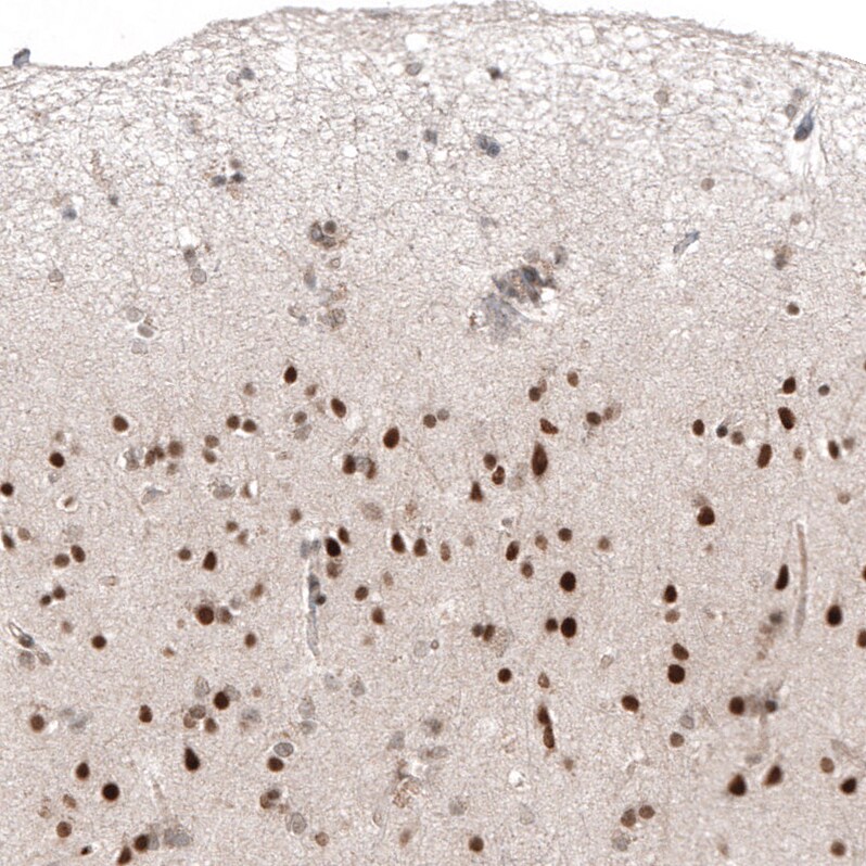 HDAC5 Antibody (CL8121) - Azide and BSA Free Immunohistochemistry-Paraffin: HDAC5 Antibody [NBP3-44217]
