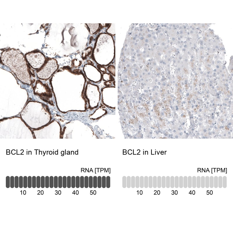 Bcl-2 Antibody (CL7935) - Azide and BSA Free Immunohistochemistry-Paraffin: Bcl-2 Antibody [NBP3-44218]