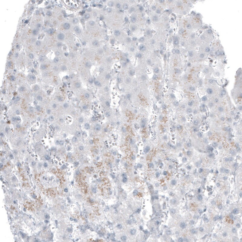 Bcl-2 Antibody (CL7935) - Azide and BSA Free Immunohistochemistry-Paraffin: Bcl-2 Antibody [NBP3-44218]