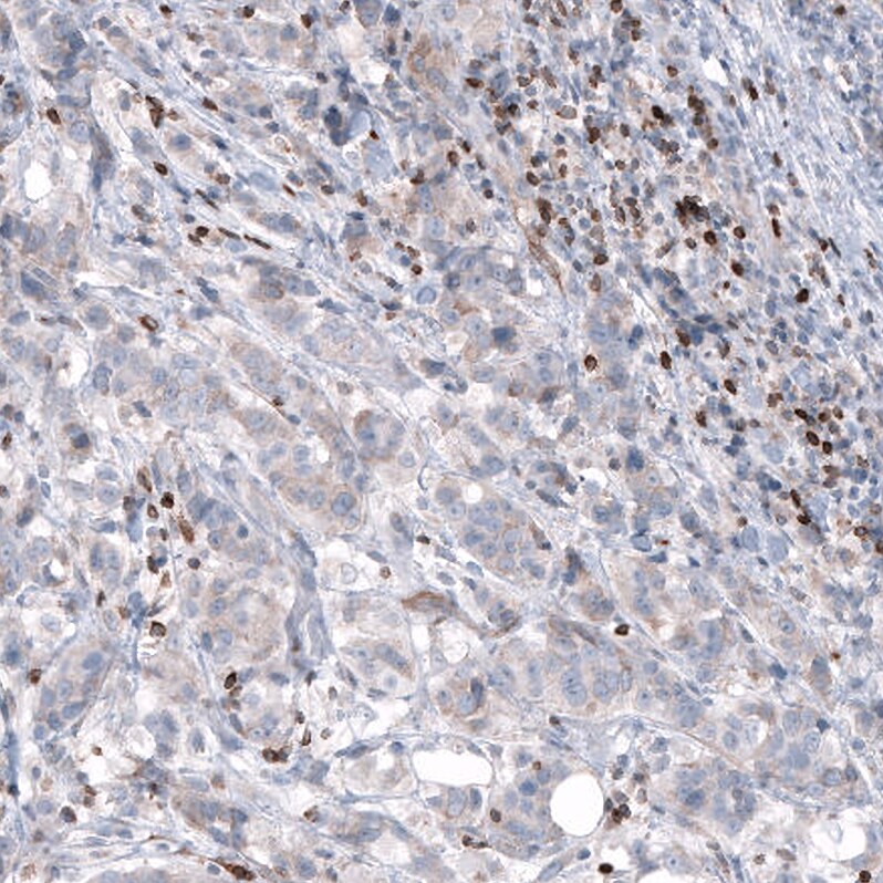 Bcl-2 Antibody (CL7935) - Azide and BSA Free Immunohistochemistry-Paraffin: Bcl-2 Antibody [NBP3-44218]