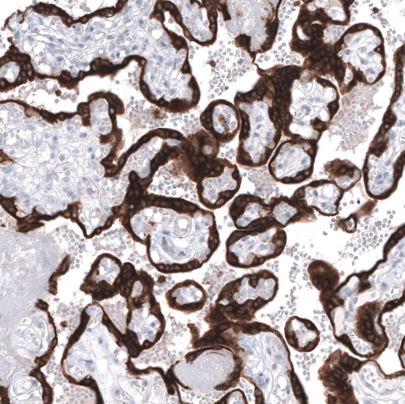 Bcl-2 Antibody (CL7935) - Azide and BSA Free Immunohistochemistry-Paraffin: Bcl-2 Antibody [NBP3-44218]