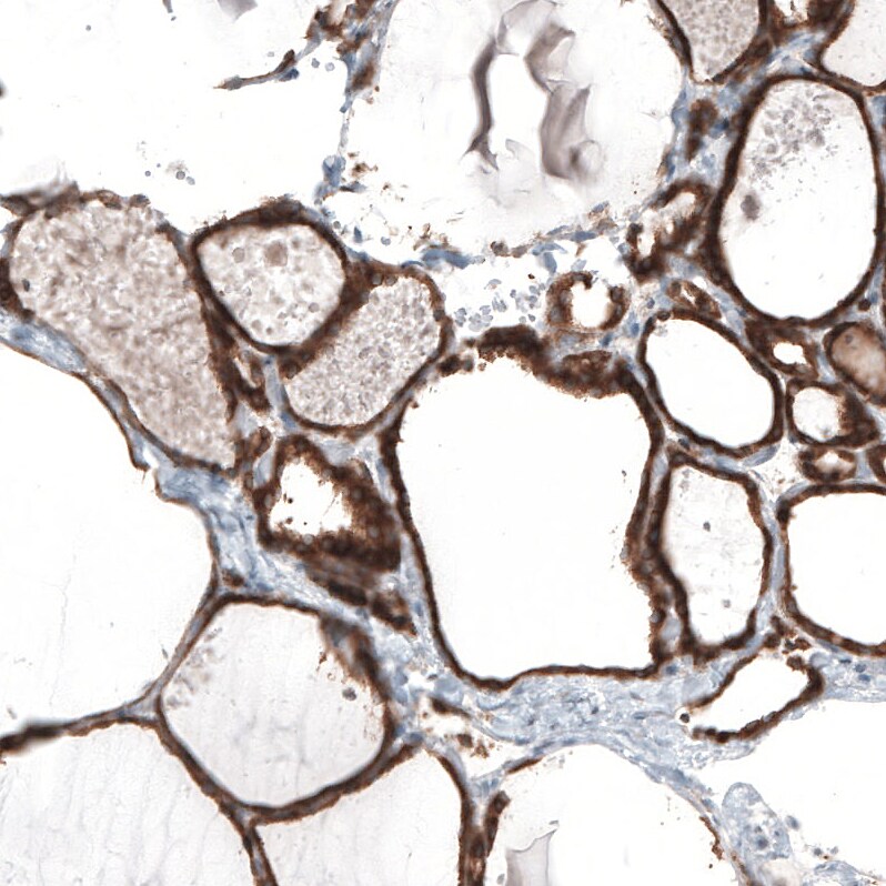Bcl-2 Antibody (CL7935) - Azide and BSA Free Immunohistochemistry-Paraffin: Bcl-2 Antibody [NBP3-44218]